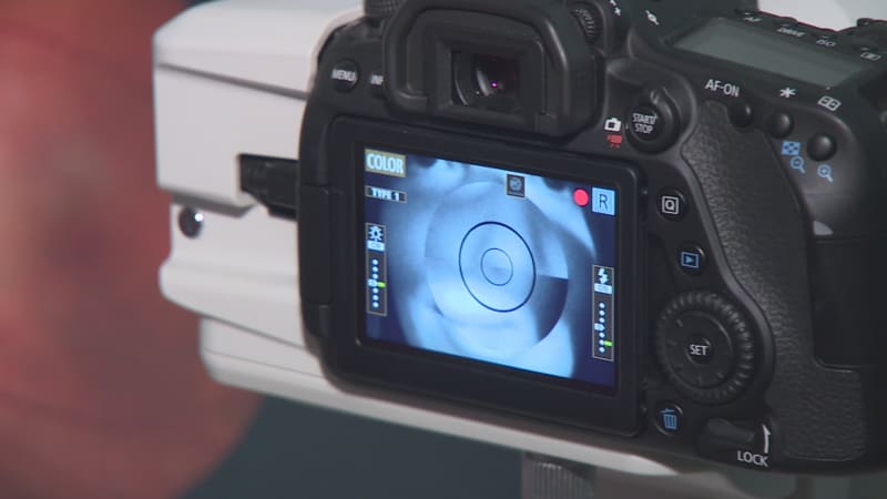 Umělá inteligence zásadně pomáhá diabetikům. Dokáže posoudit problémy se zrakem