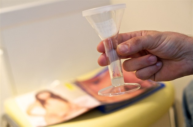 Dárce spermatu měl mutaci zvyšující riziko rakoviny, zplodil dvě stovky dětí