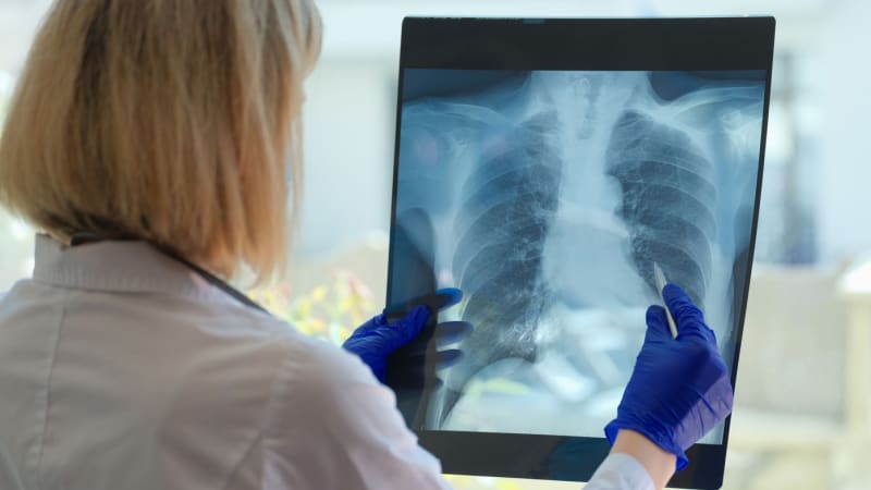 Nebývalé výsledky screeningu v Česku: Cílil na rakovinu, odhalil však i další smrtící nemoc